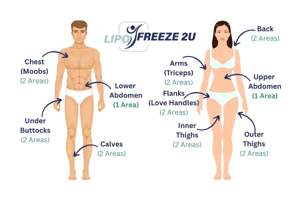 Areas you can have fat freezing treatment Barry