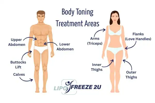 Graphic showing where you can have Body toning Treatment Barry on your body