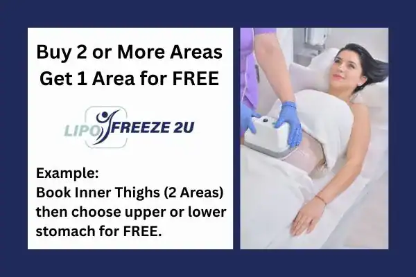 fat freezing prices Barry