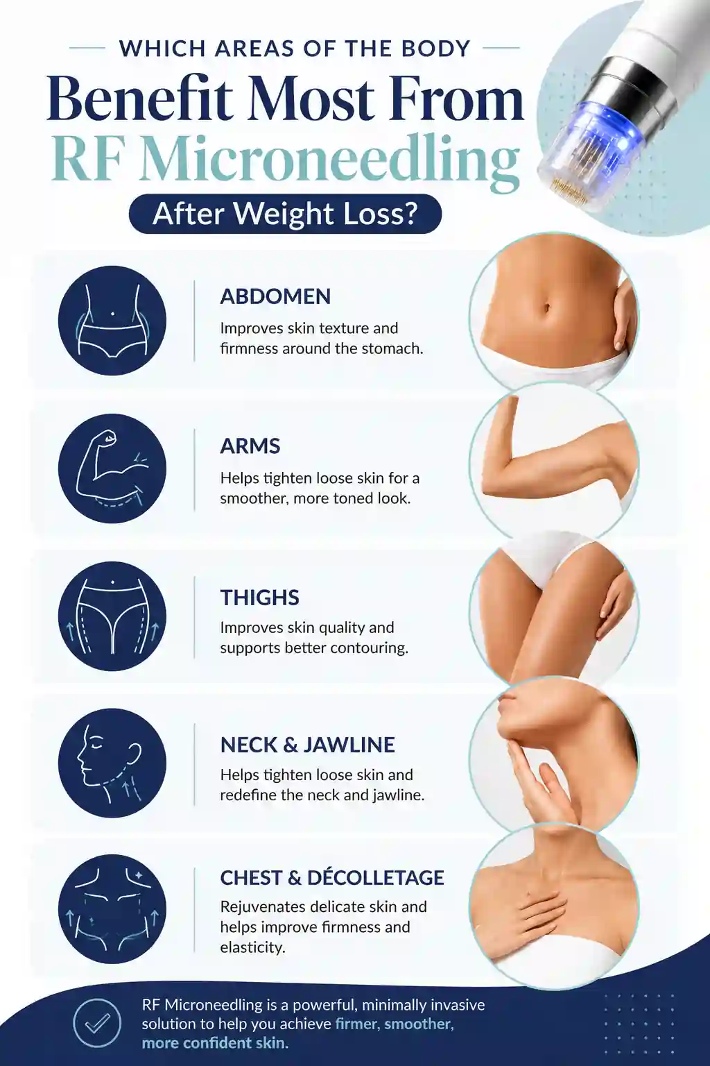 Which Areas of the Body Benefit Most From RF Microneedling After Weight Loss Barry